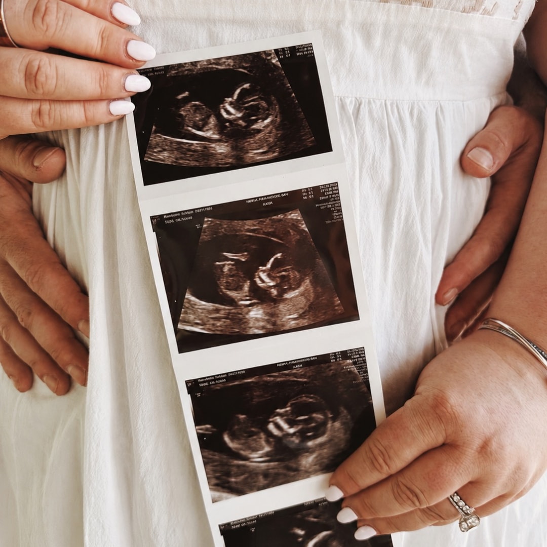 Photo shared by Siobhan for their Babylist baby registry.