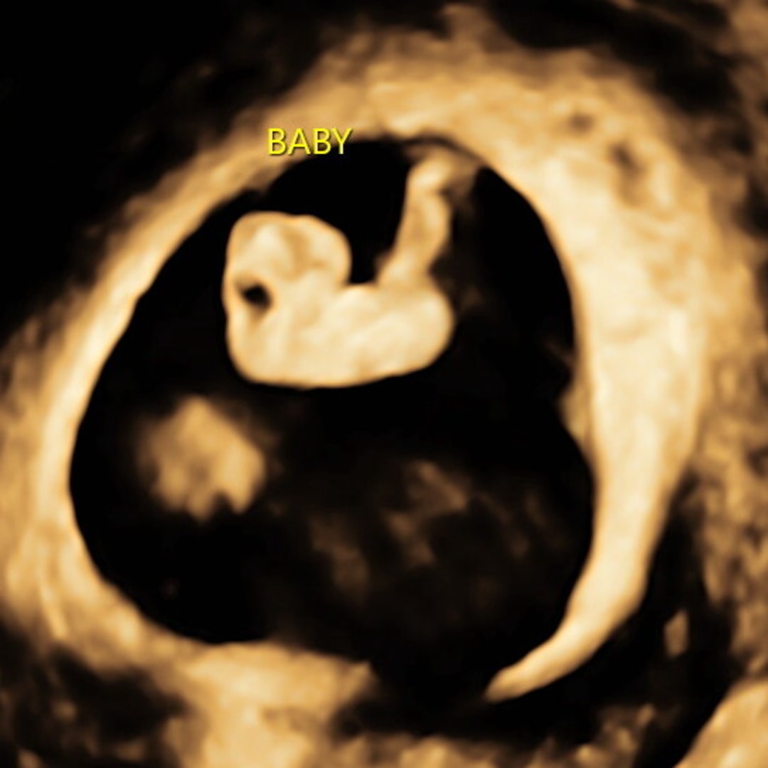 Photo shared by Carrie for their Babylist baby registry.
