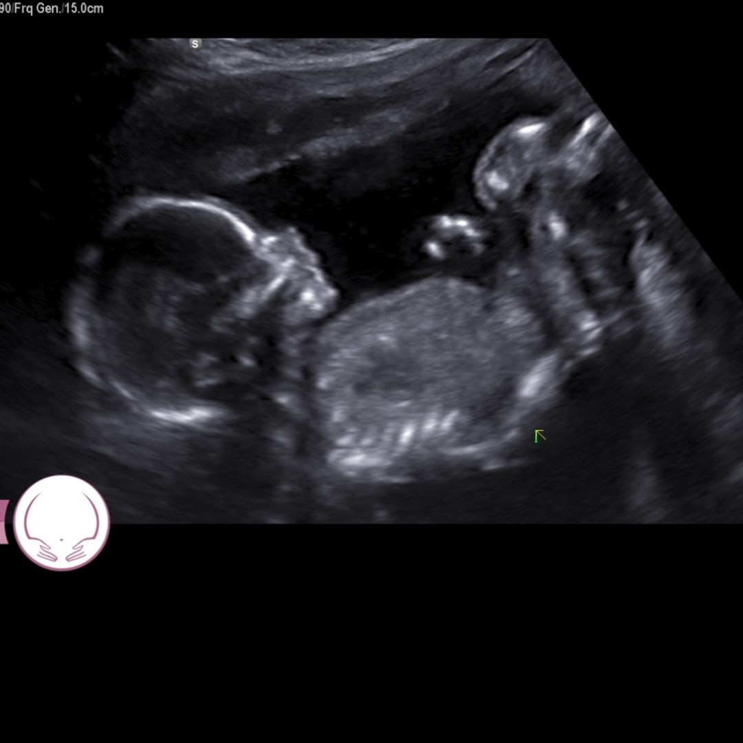 Photo shared by Shelby for their Babylist baby registry.