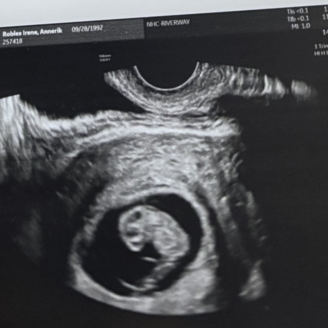 Photo shared by Annerik for their Babylist baby registry.