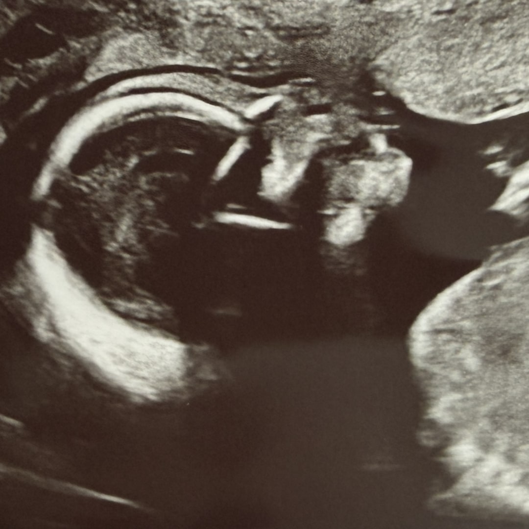 Photo shared by Jaimee for their Babylist baby registry.