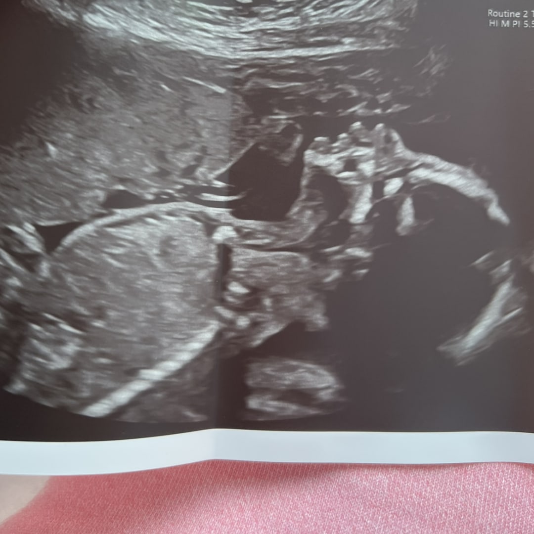 Photo shared by Madisonn for their Babylist baby registry.