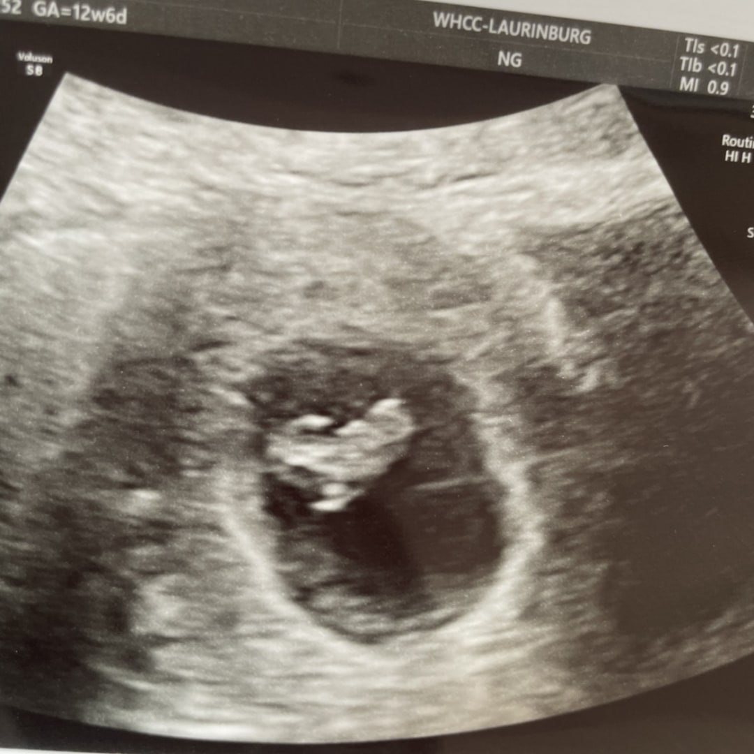 Photo shared by Alissa for their Babylist baby registry.