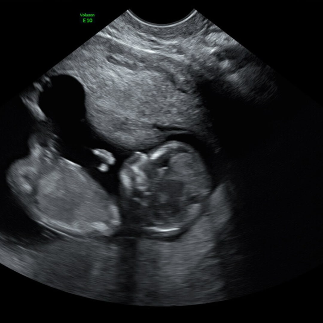 Photo shared by Reyn for their Babylist baby registry.