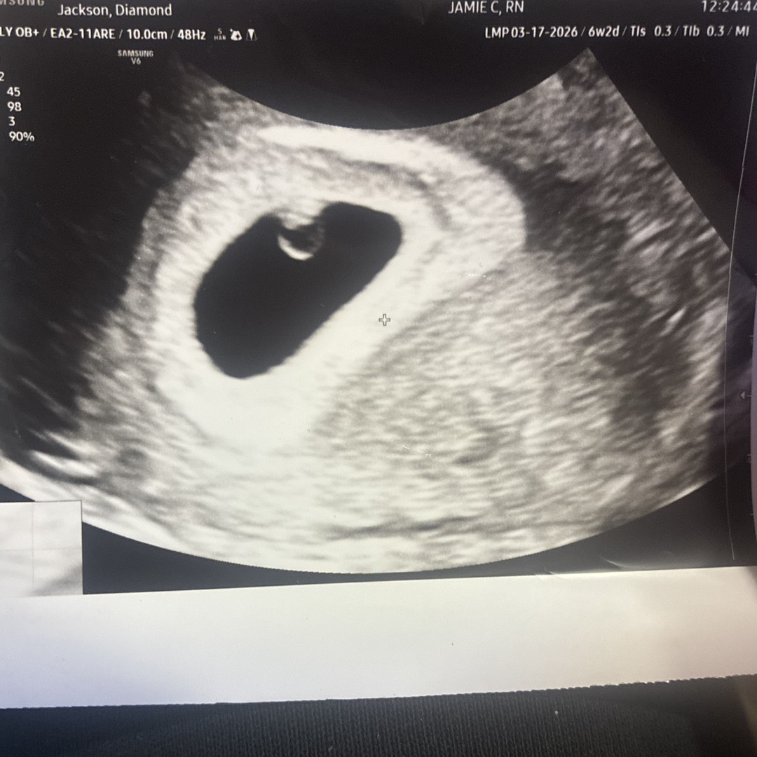 Photo shared by Diamond for their Babylist baby registry.