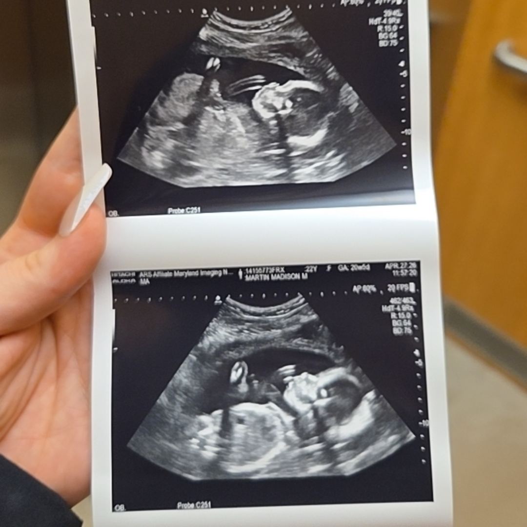 Photo shared by Madison for their Babylist baby registry.