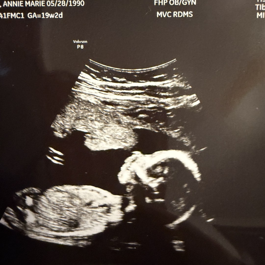 Photo shared by Annie for their Babylist baby registry.