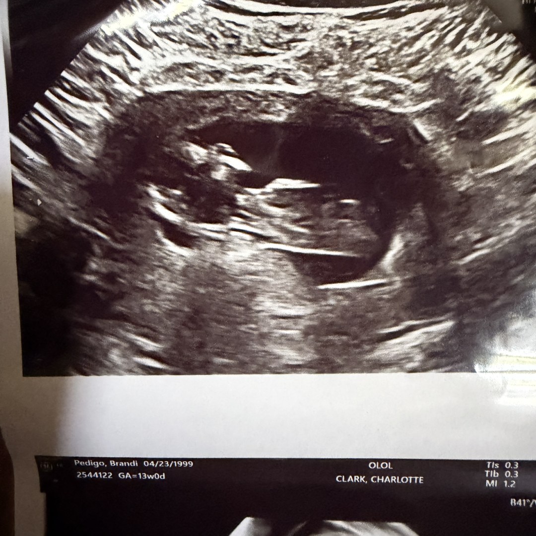 Photo shared by Brandi for their Babylist baby registry.