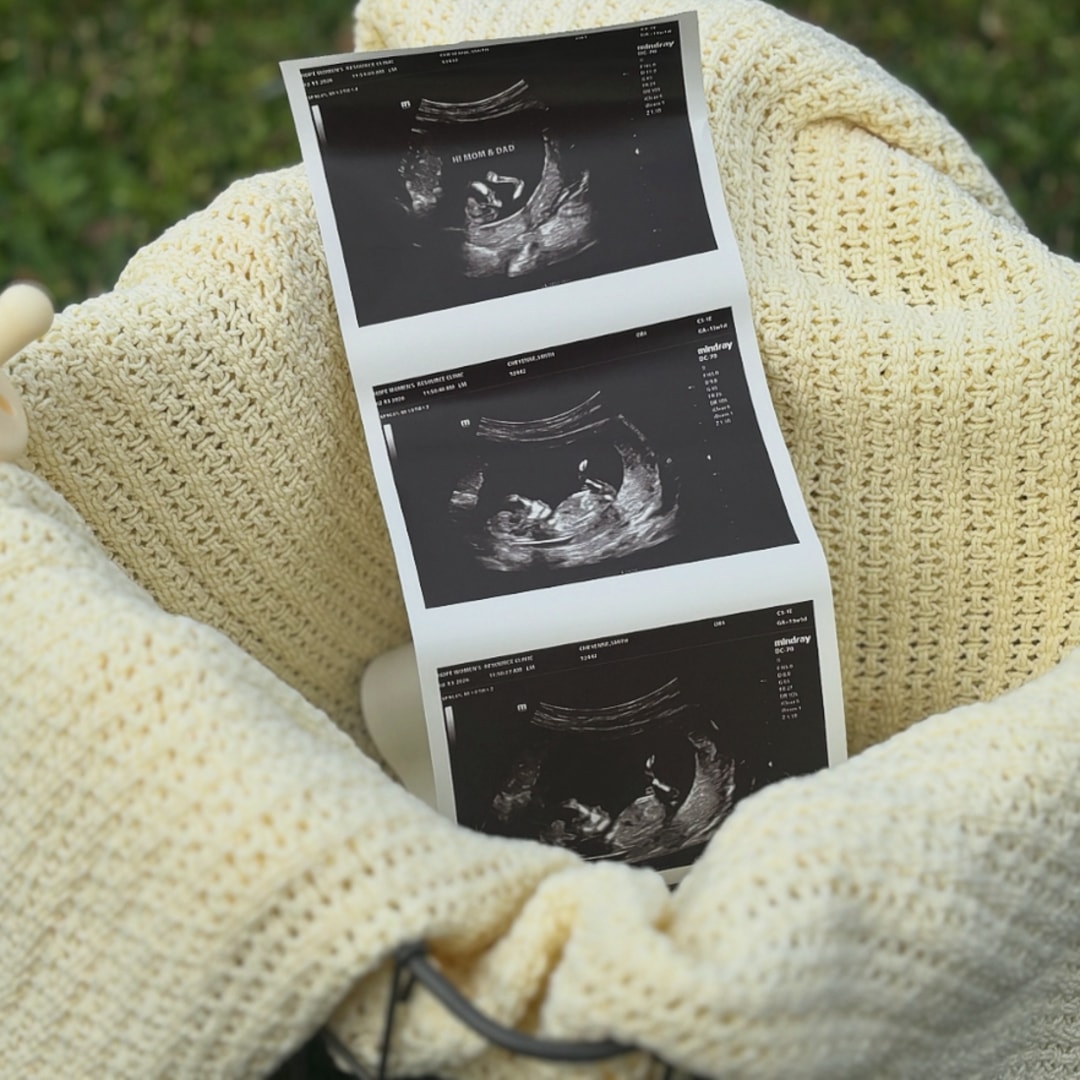 Photo shared by Cheyenne for their Babylist baby registry.