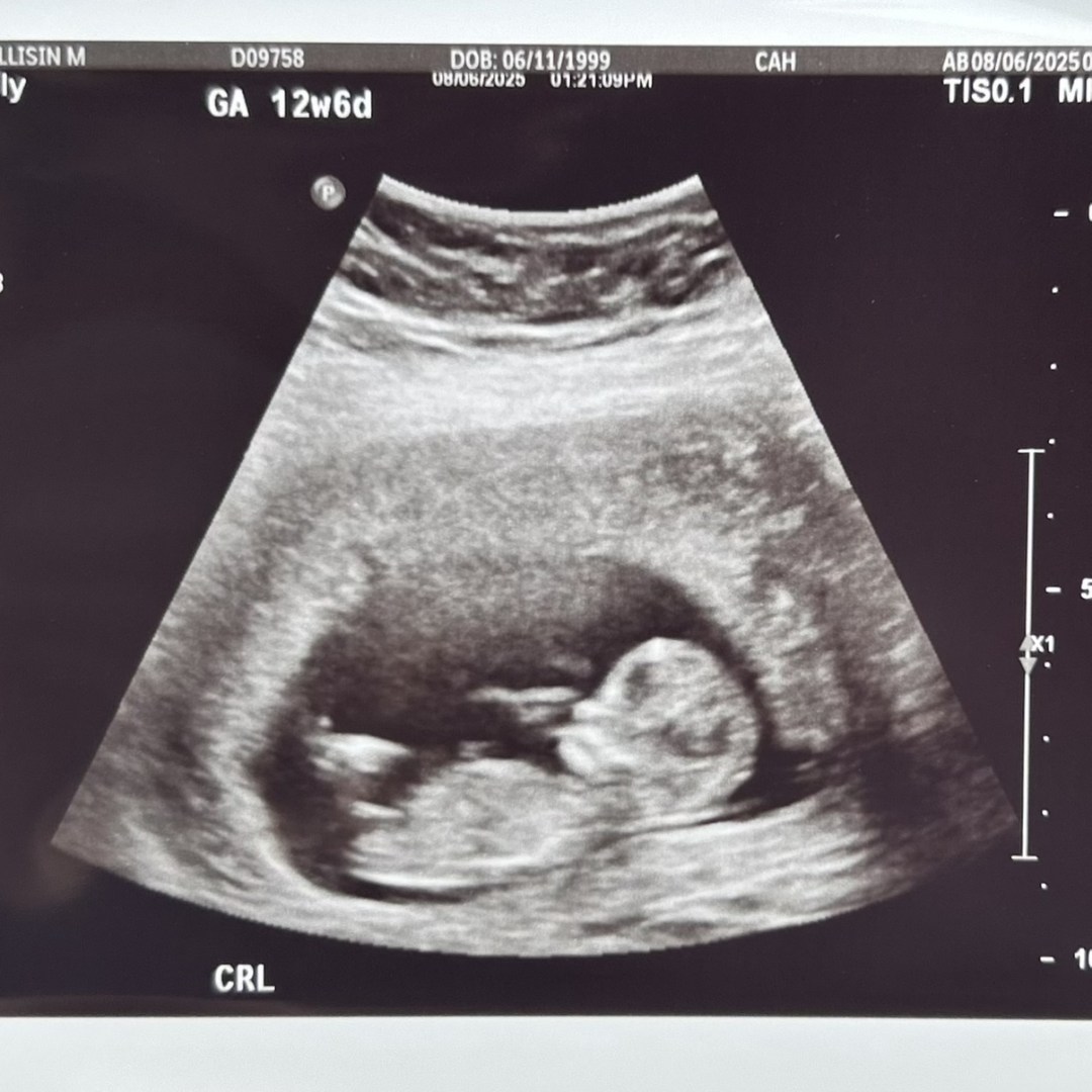 Photo shared by Allisin for their Babylist baby registry.