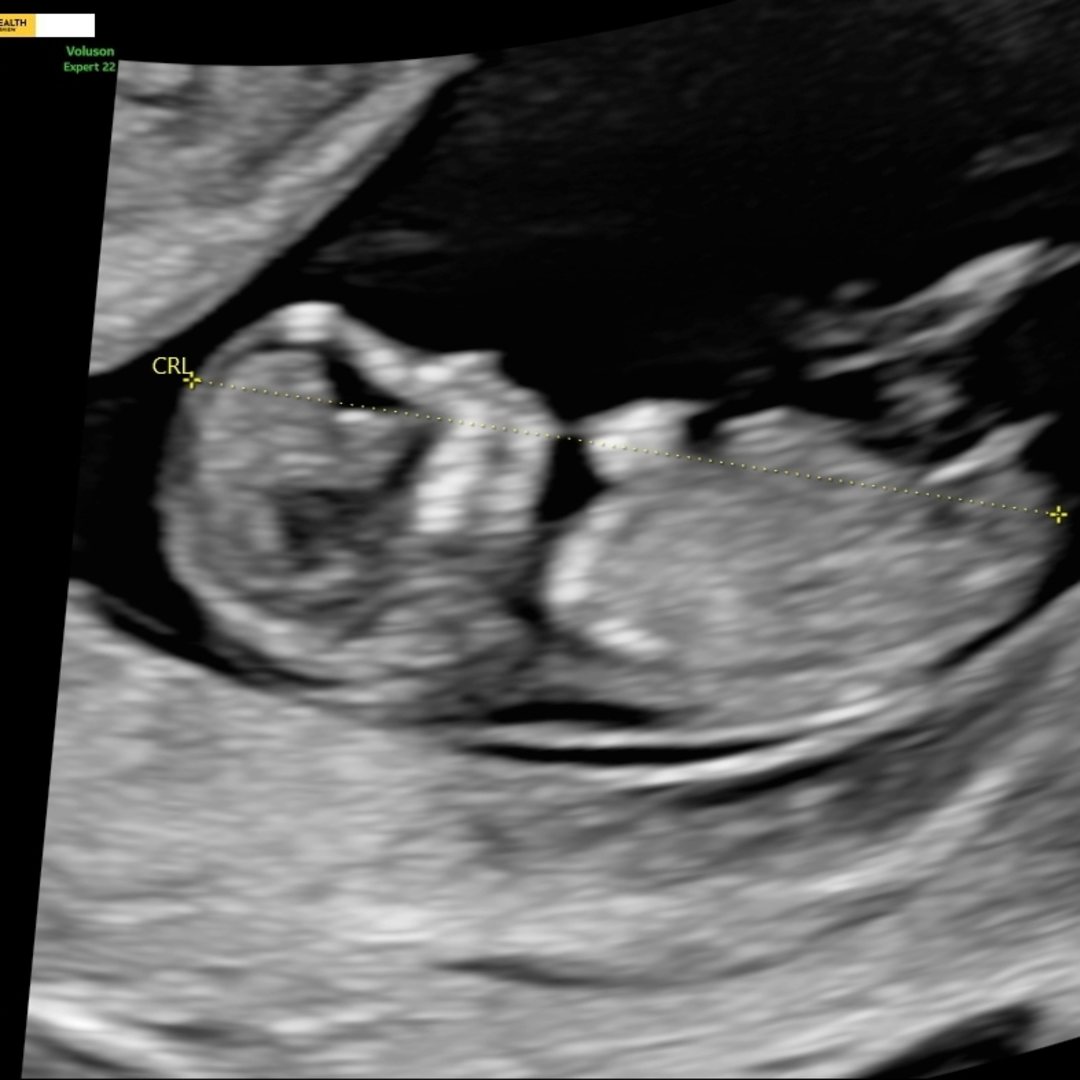 Photo shared by Chauntrice for their Babylist baby registry.