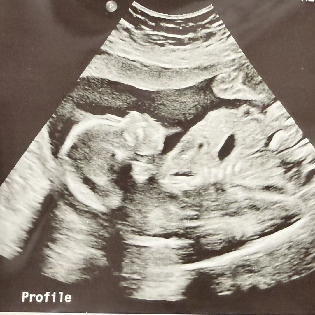 Photo shared by Gledys for their Babylist baby registry.