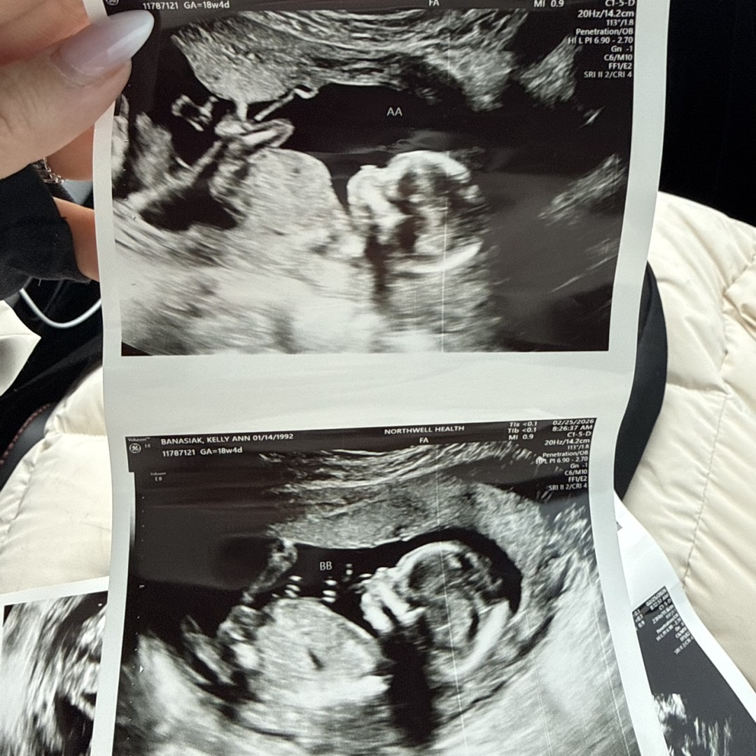 Photo shared by Kelly for their Babylist baby registry.