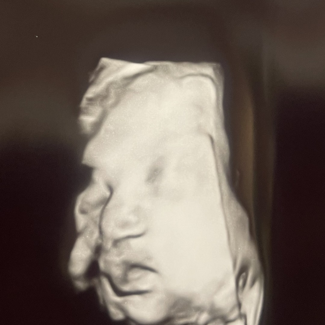 Photo shared by Trang for their Babylist baby registry.