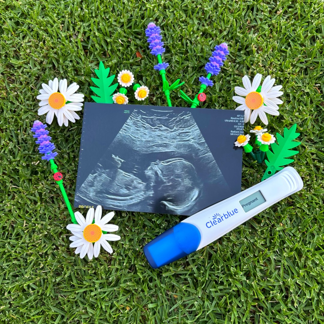 Photo shared by Scarlett for their Babylist baby registry.