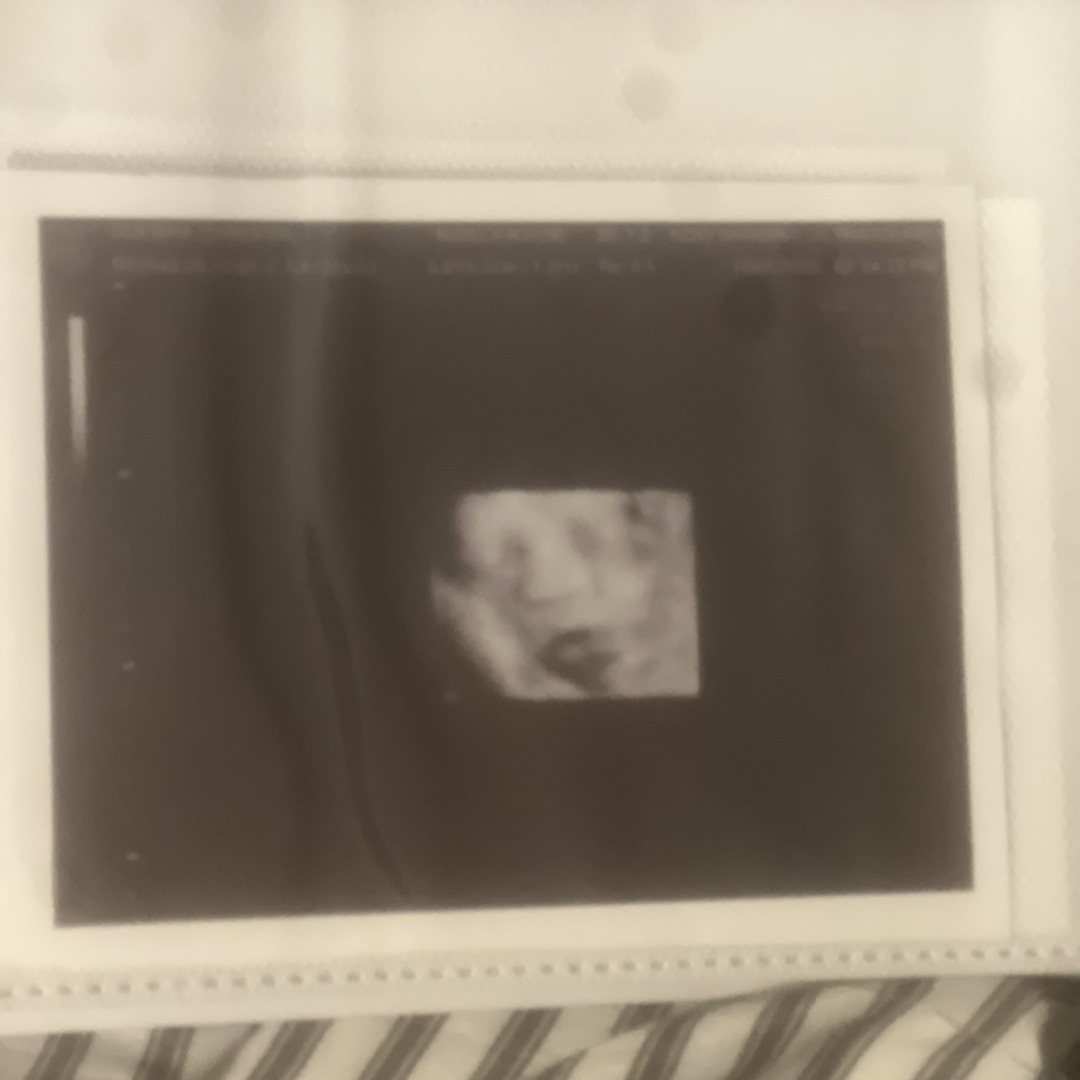 Photo shared by Christal for their Babylist baby registry.