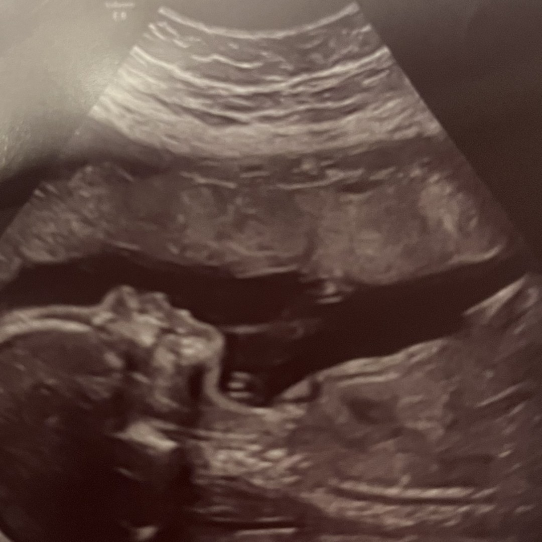 Photo shared by Karen for their Babylist baby registry.