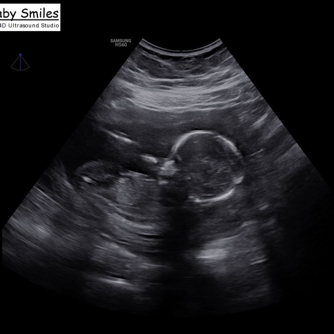 Photo shared by Ashlyn for their Babylist baby registry.