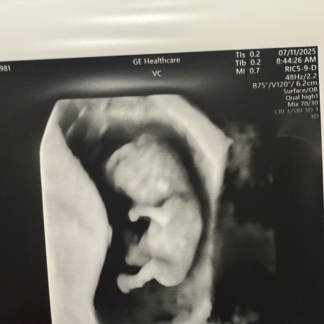Photo shared by Betsy for their Babylist baby registry.