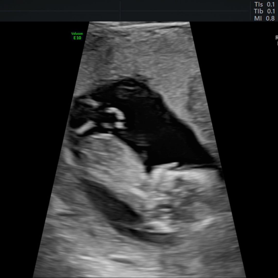 Photo shared by Mackenzie for their Babylist baby registry.