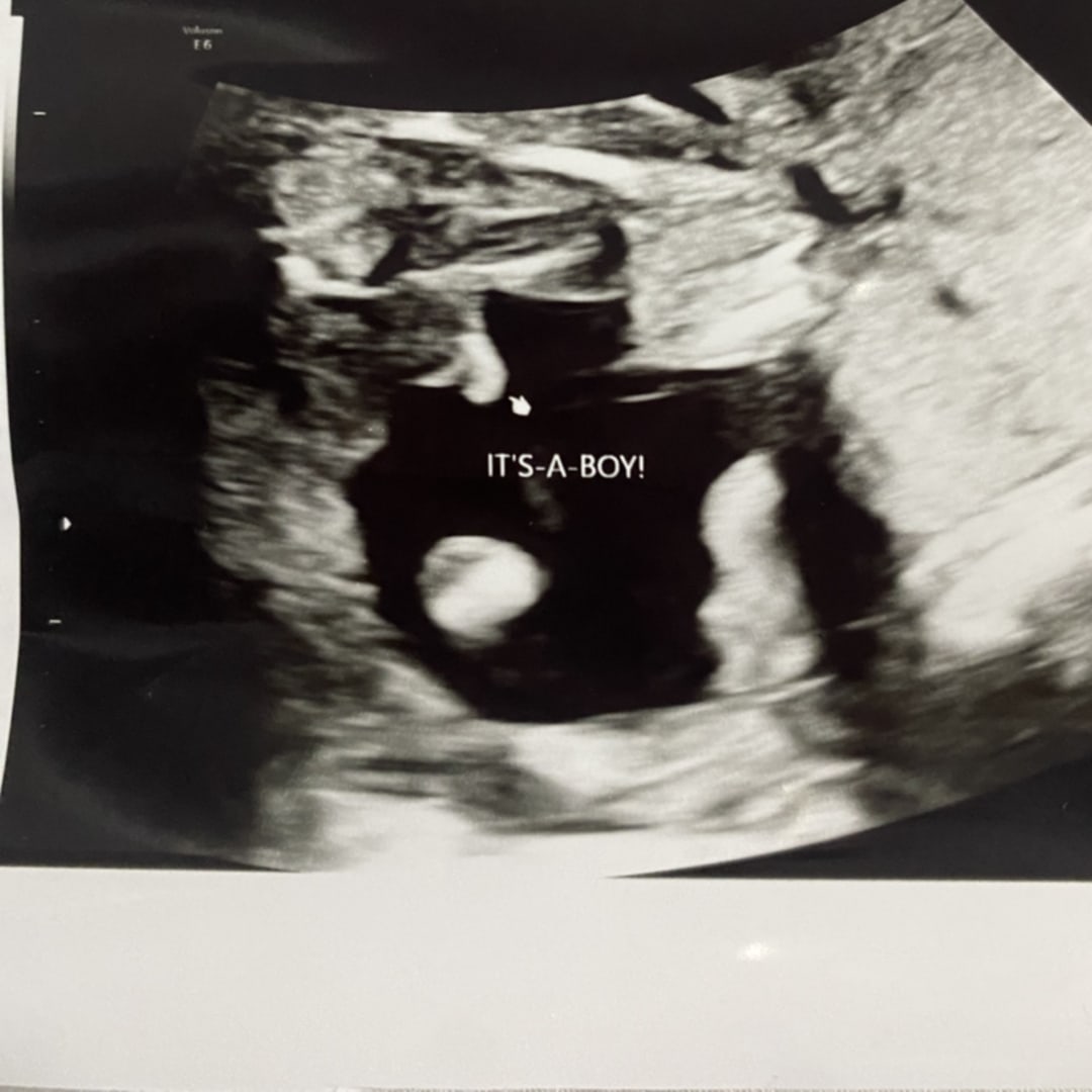 Photo shared by Brandi for their Babylist baby registry.