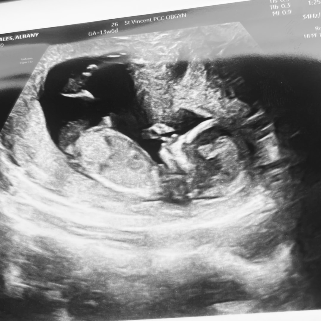 Photo shared by Albany for their Babylist baby registry.