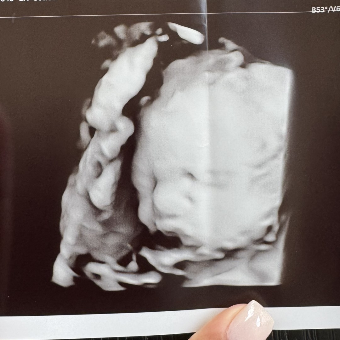 Photo shared by Deana for their Babylist baby registry.