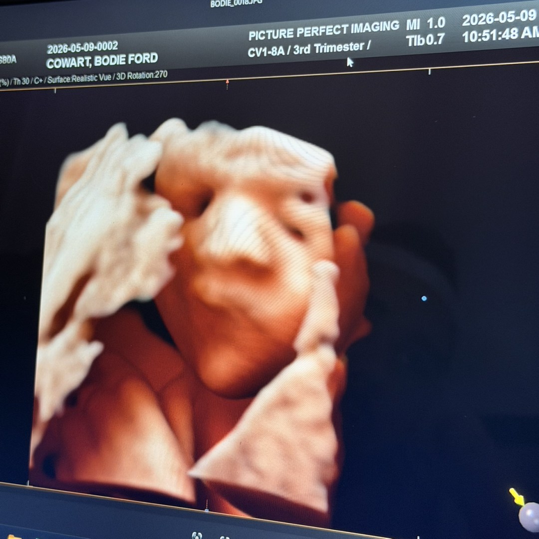 Photo shared by Megan for their Babylist baby registry.