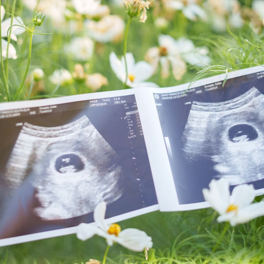Photo shared by Kylee for their Babylist baby registry.