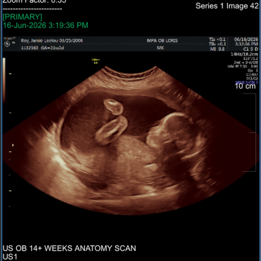 Photo shared by Jamie for their Babylist baby registry.