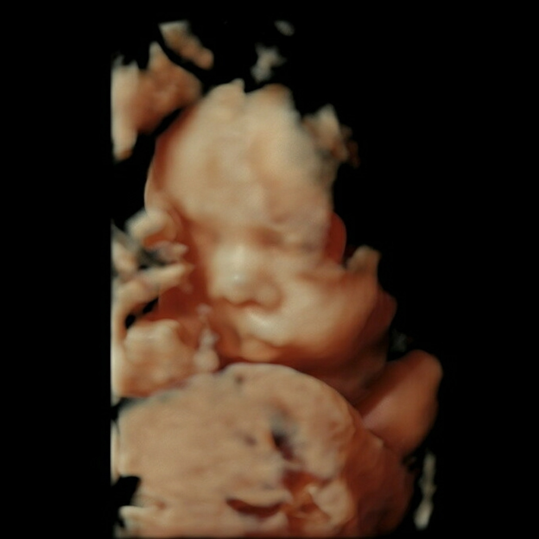 Photo shared by Hannah for their Babylist baby registry.