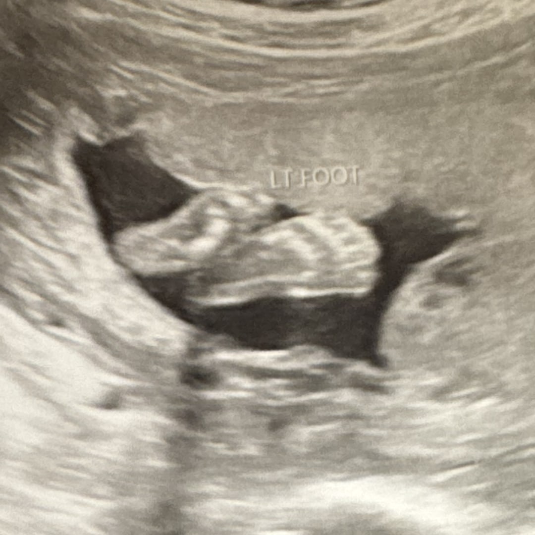 Photo shared by Mia for their Babylist baby registry.