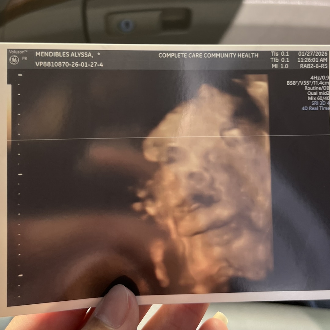 Photo shared by Alyssa for their Babylist baby registry.