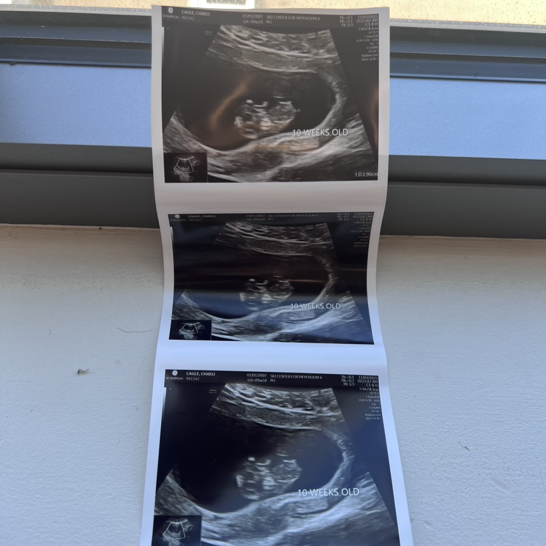 Photo shared by Chaeli for their Babylist baby registry.