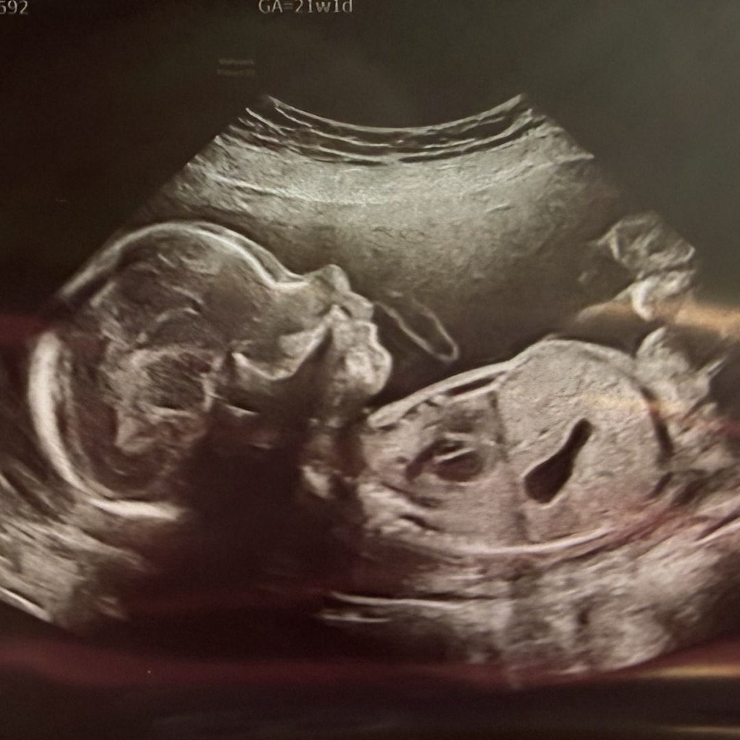 Photo shared by Donna for their Babylist baby registry.