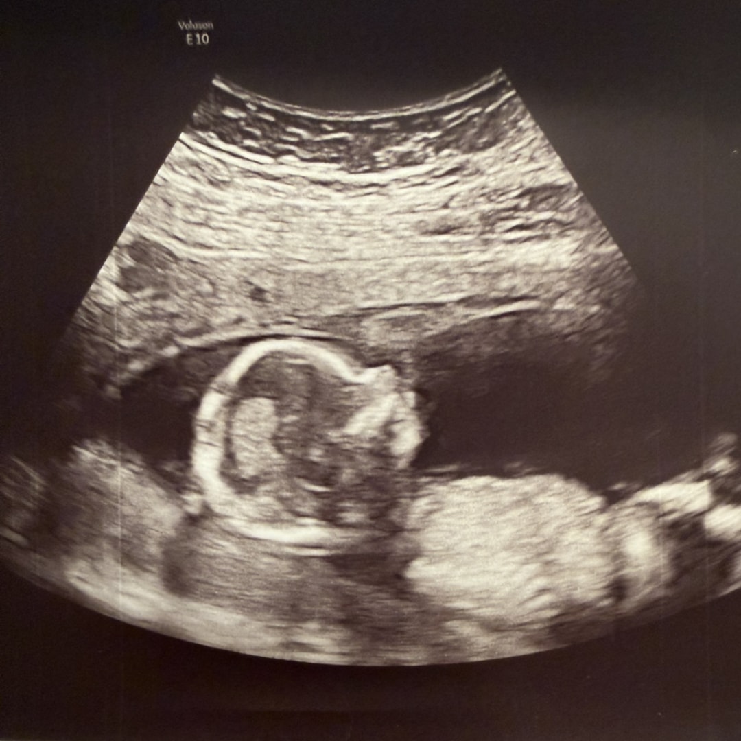 Photo shared by Cristal for their Babylist baby registry.