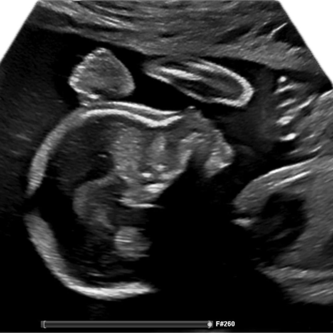 Photo shared by Sarah for their Babylist baby registry.