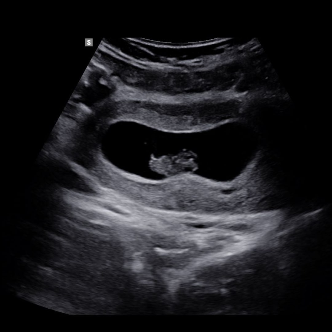 Photo shared by Jillian for their Babylist baby registry.