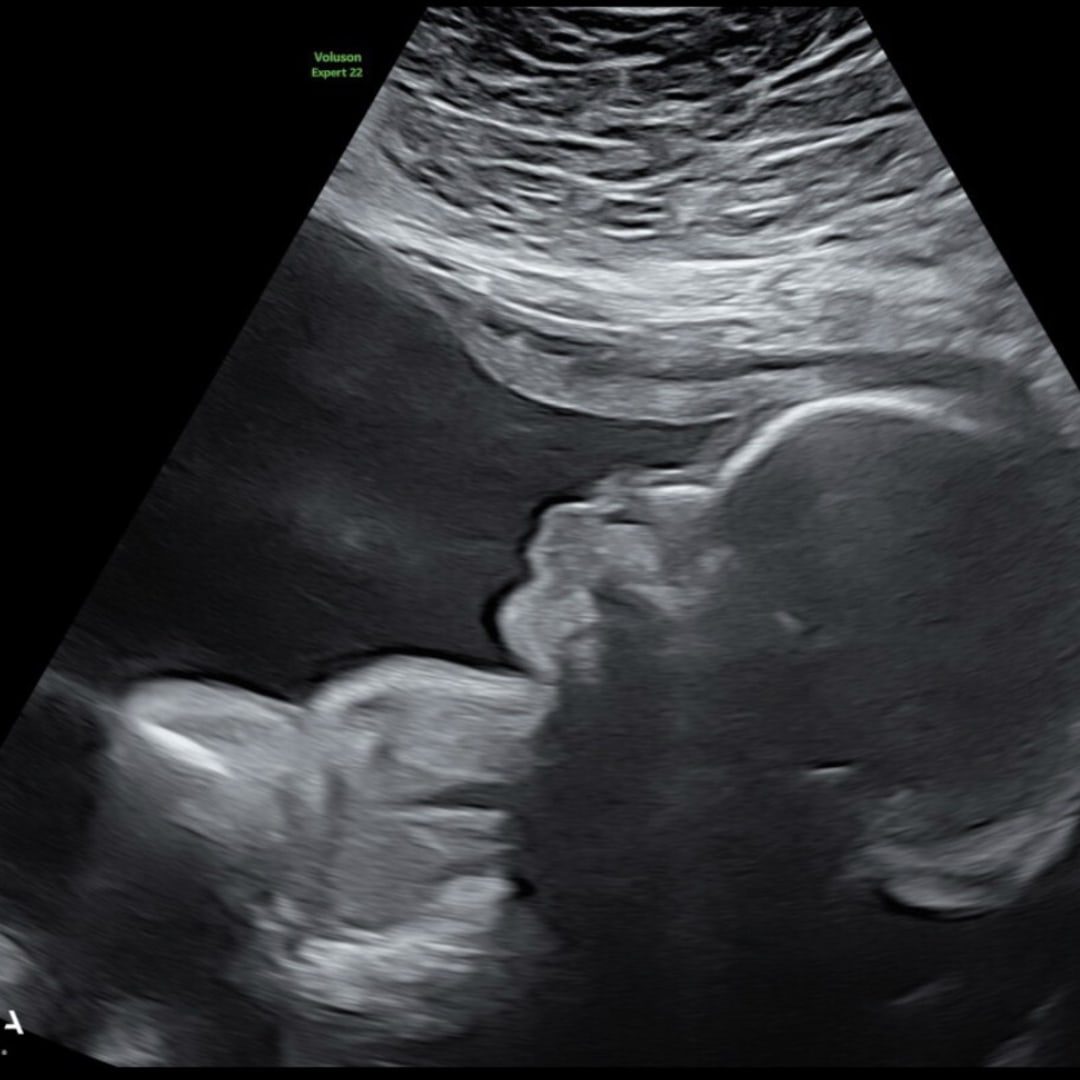 Photo shared by Savannah for their Babylist baby registry.
