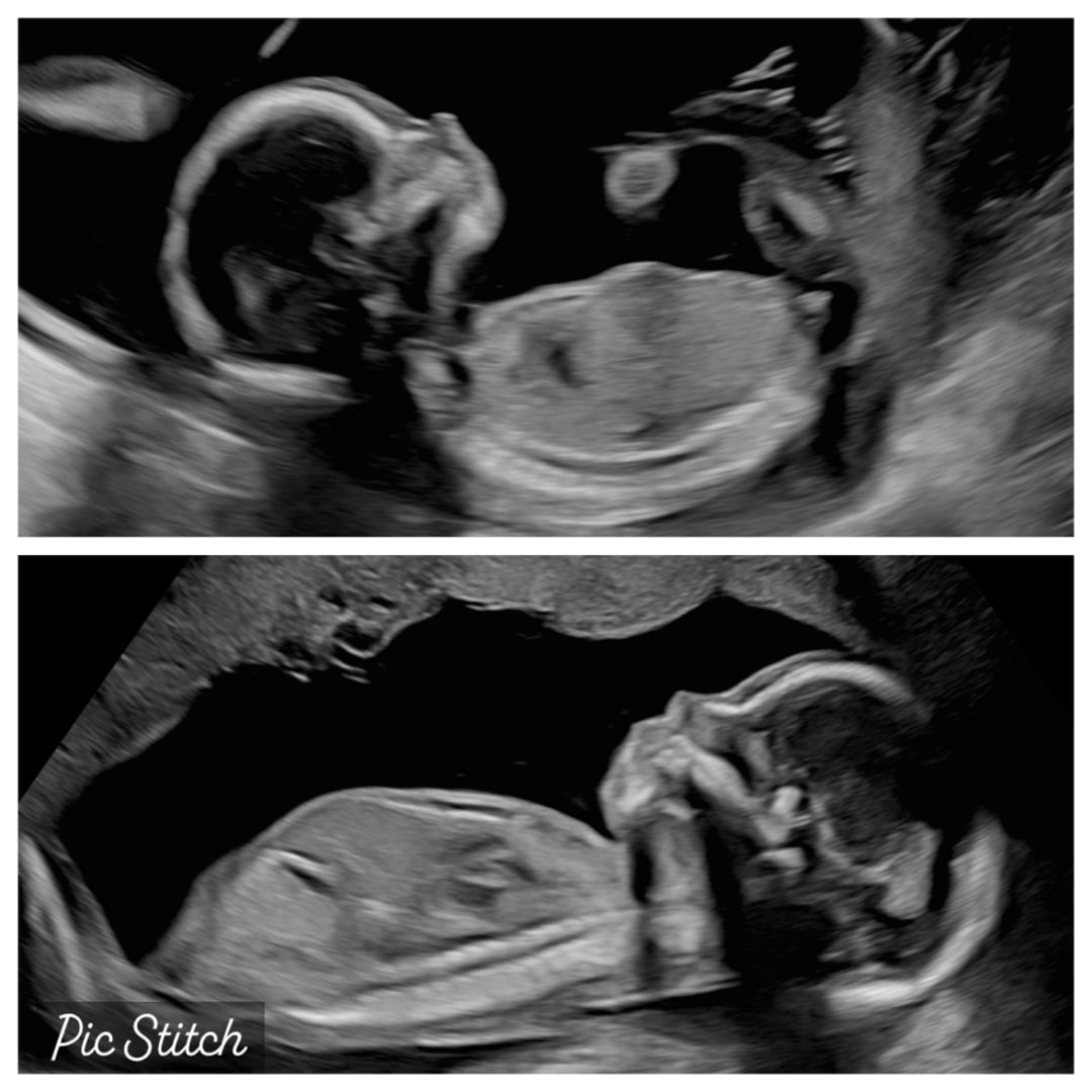 Photo shared by Ashton for their Babylist baby registry.