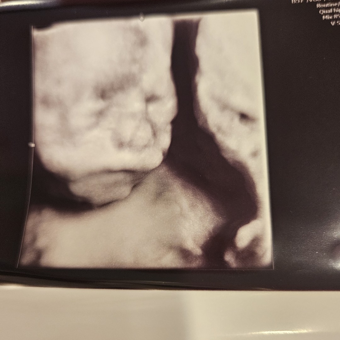 Photo shared by Rachel for their Babylist baby registry.
