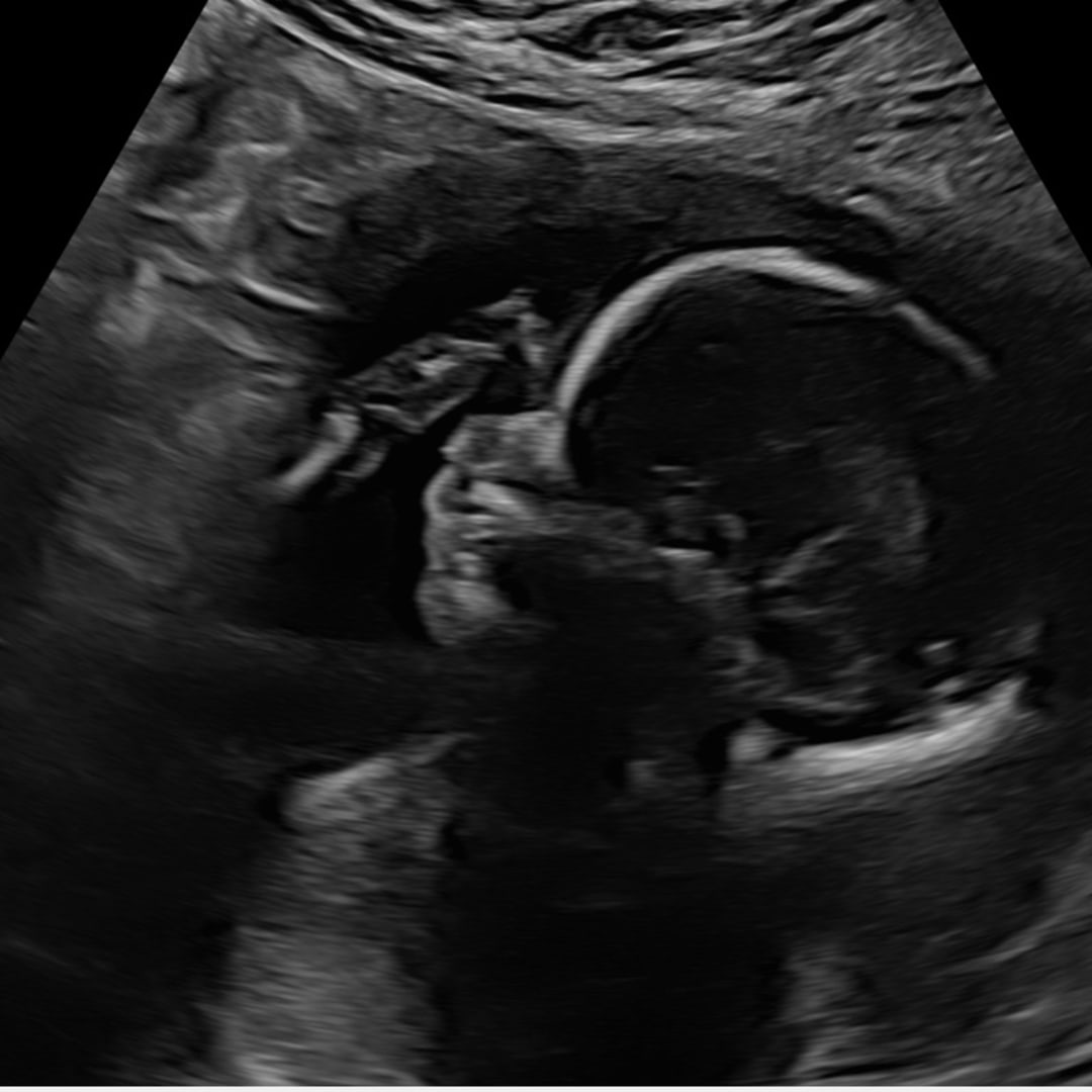 Photo shared by Katherine for their Babylist baby registry.