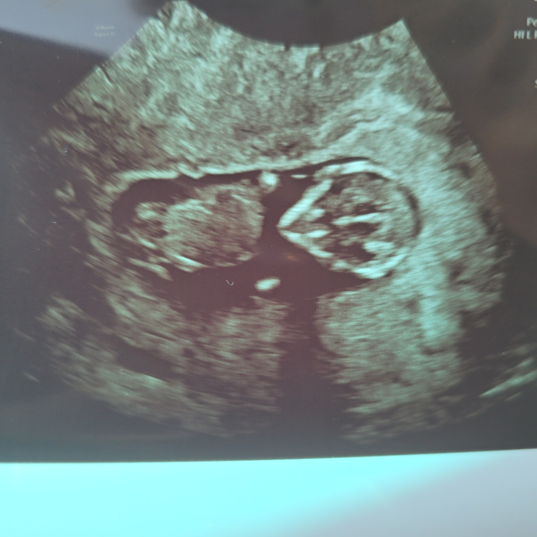 Photo shared by Ja for their Babylist baby registry.