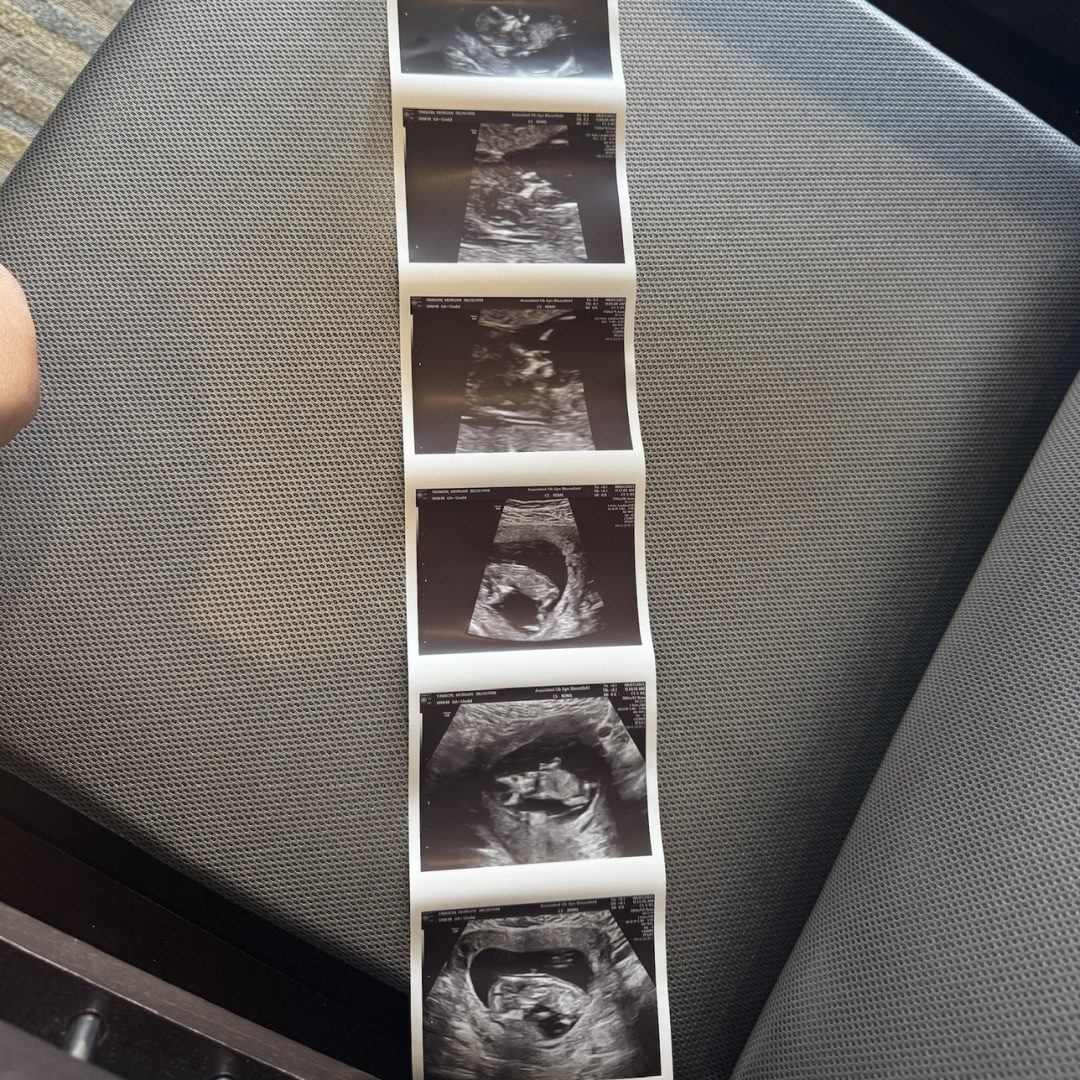 Photo shared by Morgan for their Babylist baby registry.
