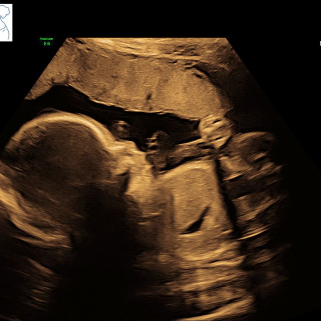 Photo shared by Megan for their Babylist baby registry.