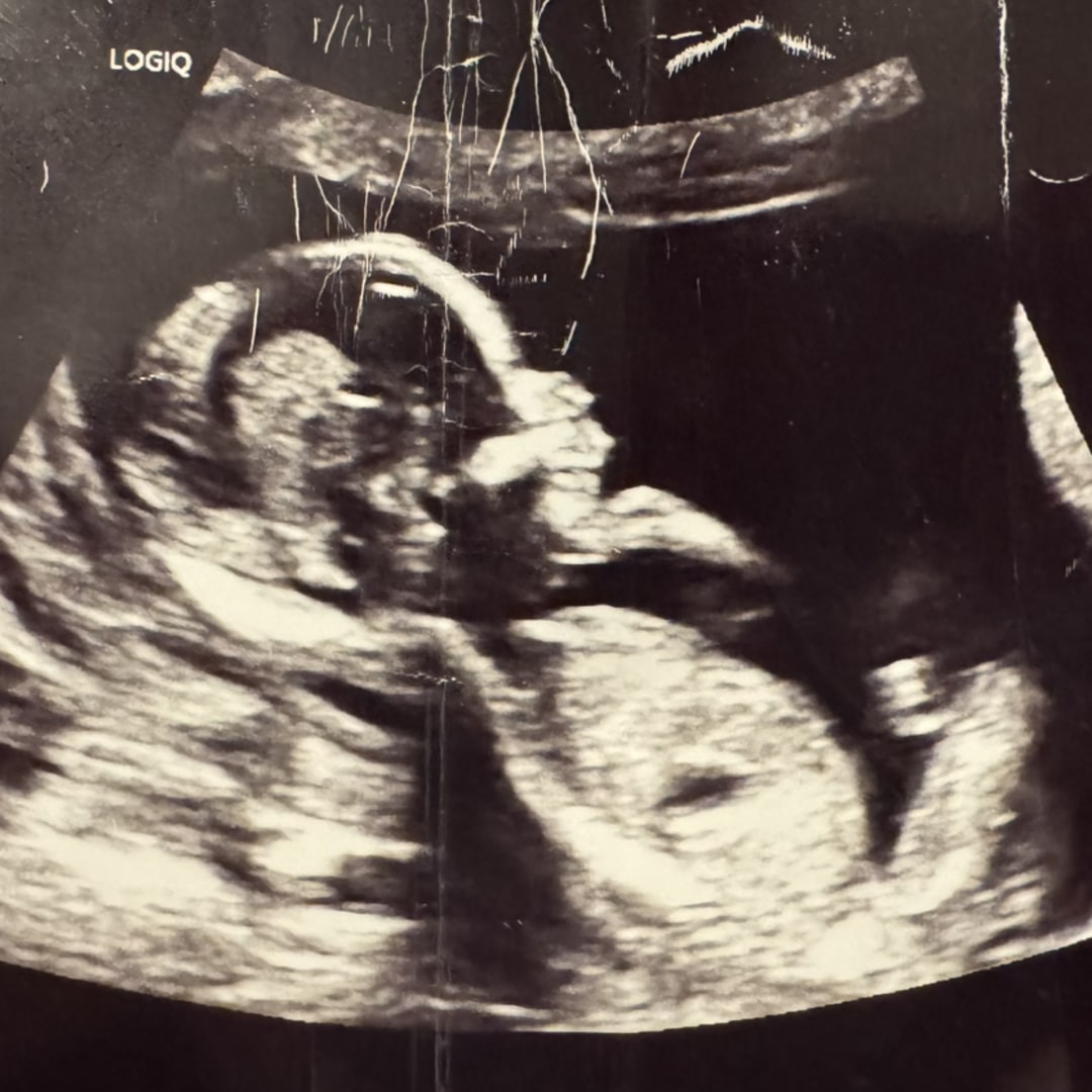 Photo shared by Elizabeth for their Babylist baby registry.