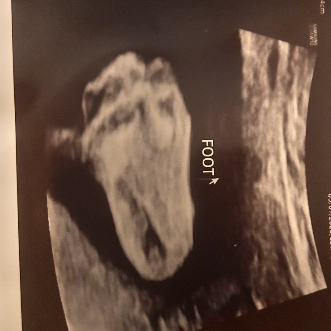 Photo shared by Madeline for their Babylist baby registry.