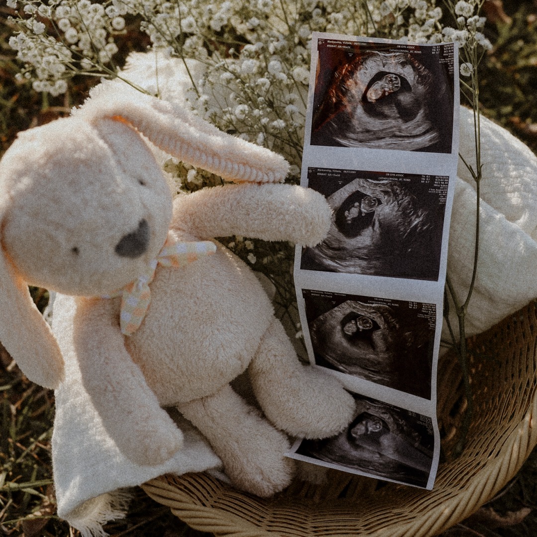 Photo shared by Victoria for their Babylist baby registry.