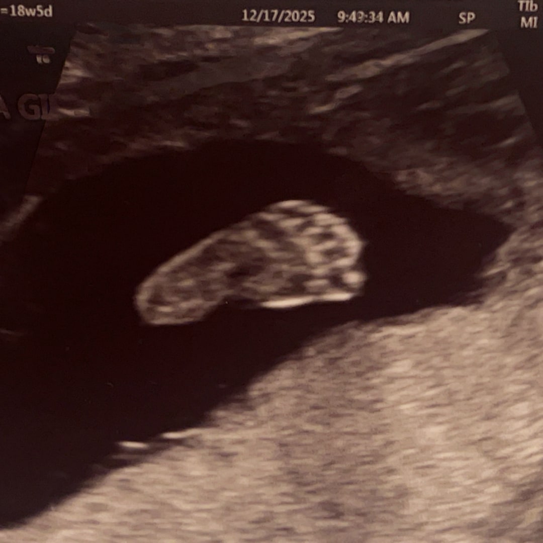 Photo shared by Kenna for their Babylist baby registry.