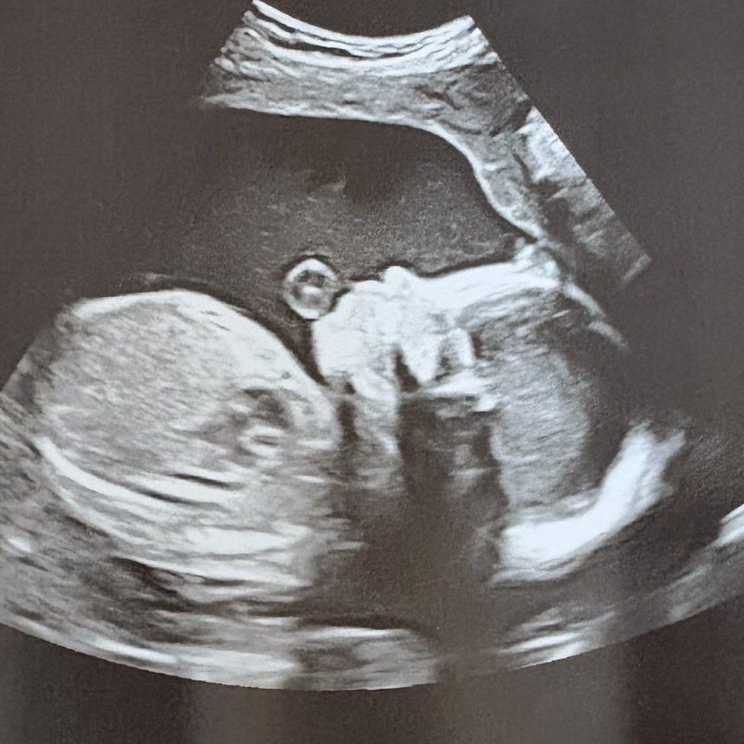 Photo shared by Claudia for their Babylist baby registry.